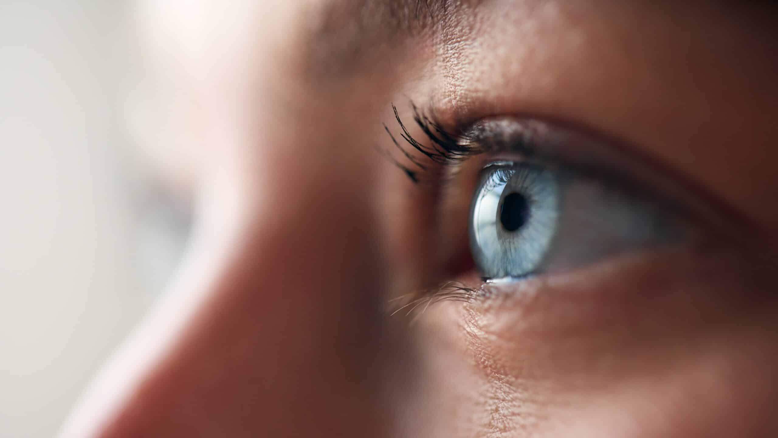 Keratoconus